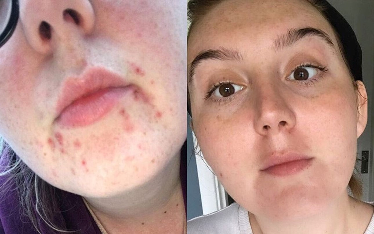 Latest before and after pictures