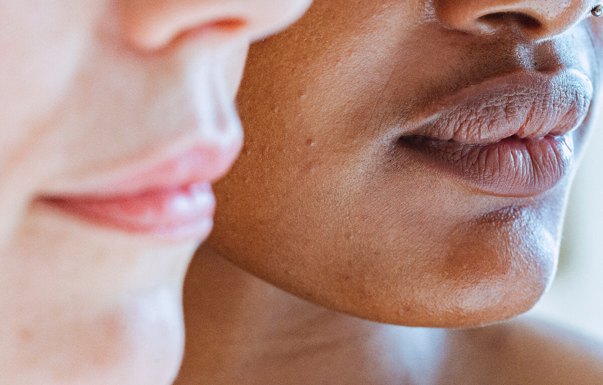 Skin purging vs skin breakouts