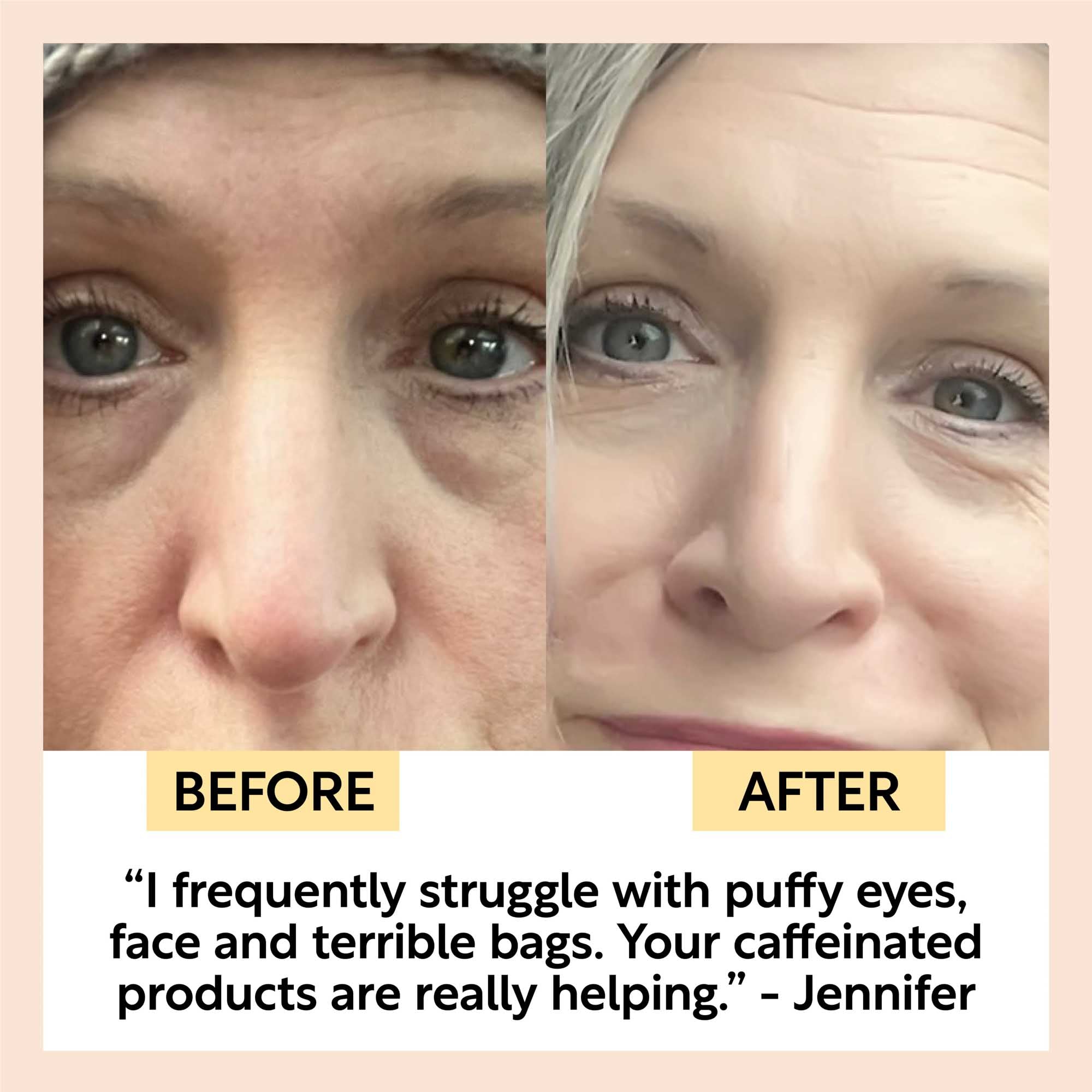 Eye Cream customer before and after: puffy eyes and bags