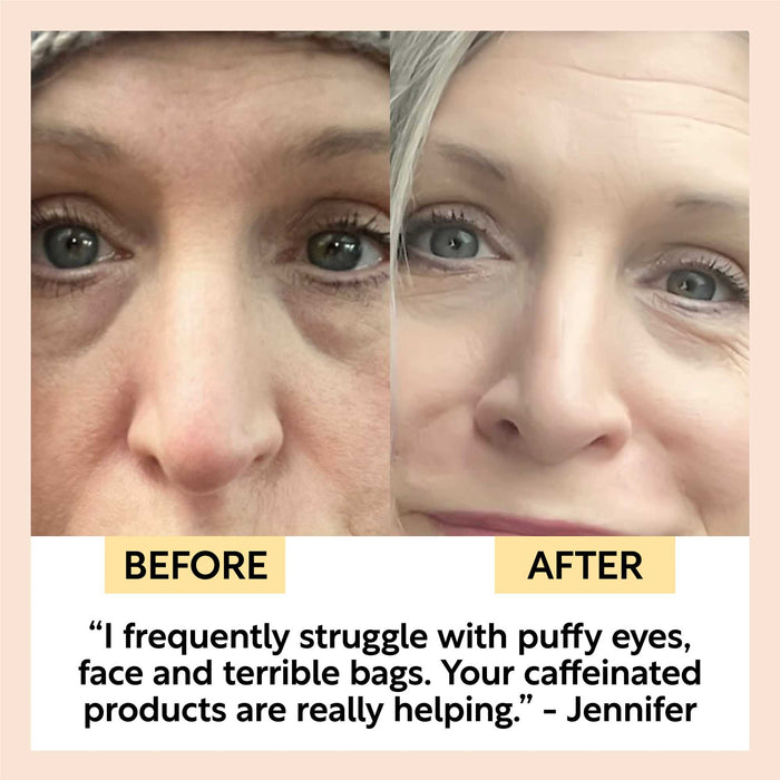 Eye Cream with Hyaluronic Acid Coffee for Dark Circles - UpCircle