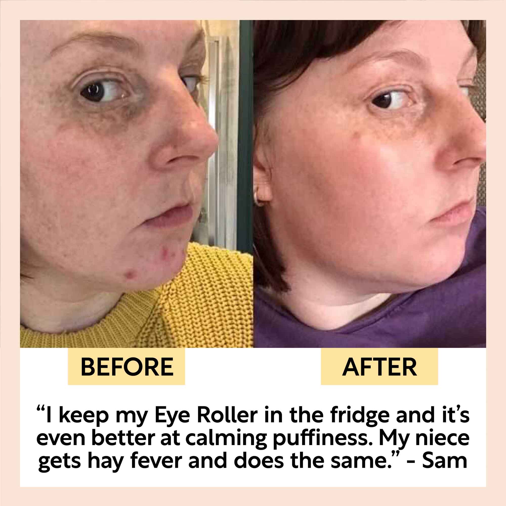 Eye Roller customer before and after, kept in the fridge for calming puffiness