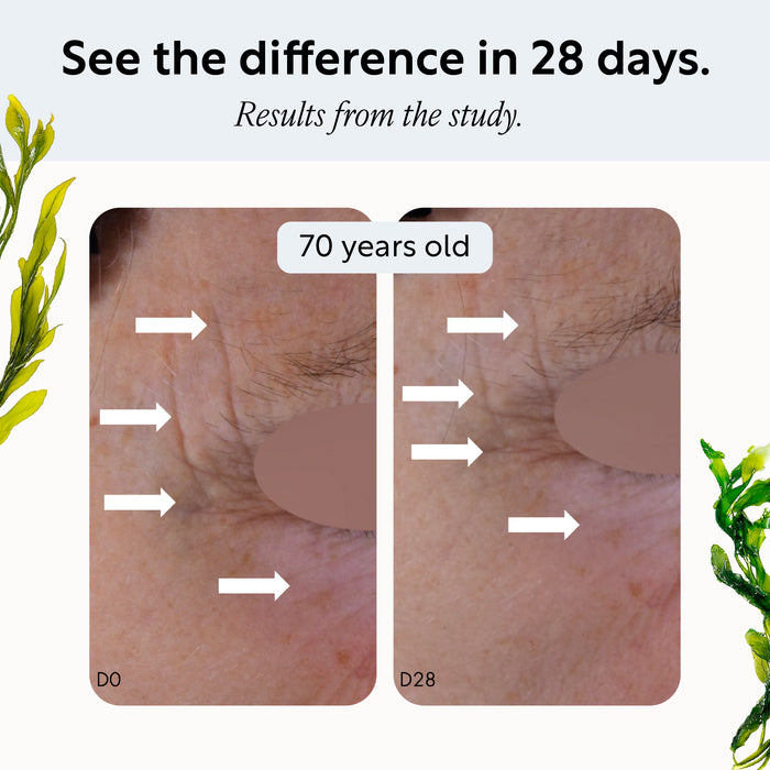 small product image-5,Opal Alga seaweed extract study, day 0 and day 28